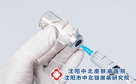 治疗牛皮癣的注射针剂有哪些?