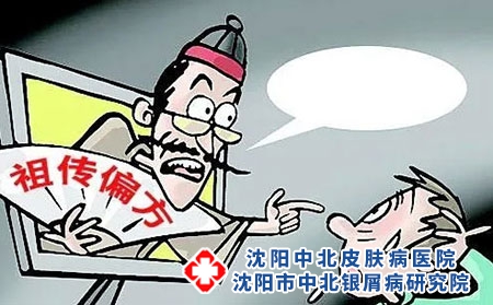 治疗牛皮癣蕞快的偏方可信吗