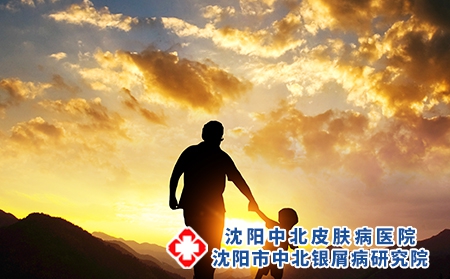 沈阳专治牛皮癣医院：牛皮癣遗传几率是多少