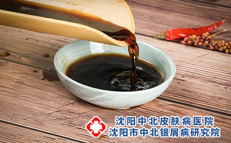 陈醋治银屑病吗?治银屑病的错误疗法都有哪些呢?