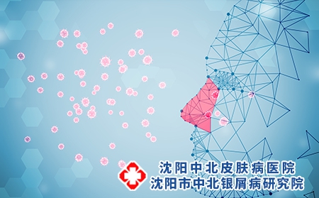 点滴型银屑病加重的症状有哪些，又应如何治疗?