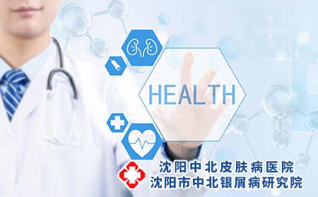 得了银屑病怎么办，有哪些治疗方式?