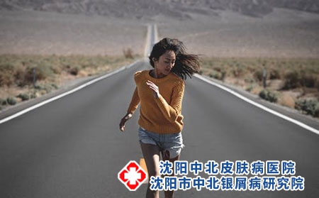 沈阳青年牛皮癣的治疗讲解