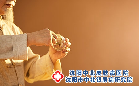 沈阳医生讲中医治牛皮癣的方法