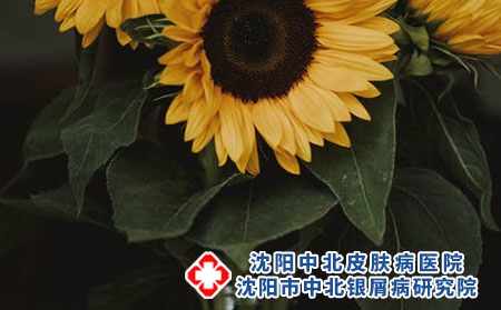 为什么别人不得银屑病，我却得了？