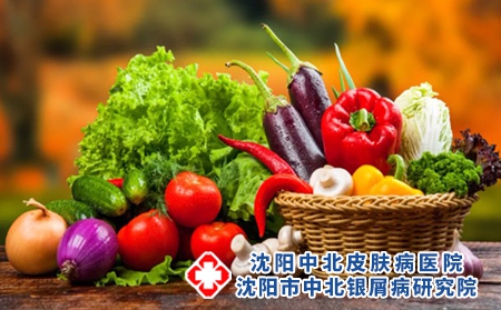 银屑病病因和食物有关系吗？