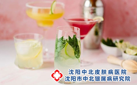 辽宁治银屑病医院建议沈阳中北:三种食物会诱发牛皮癣