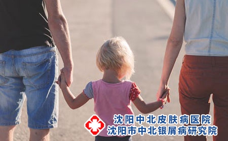 辽宁银屑病医院中北:三种方法降低牛皮癣遗传几率