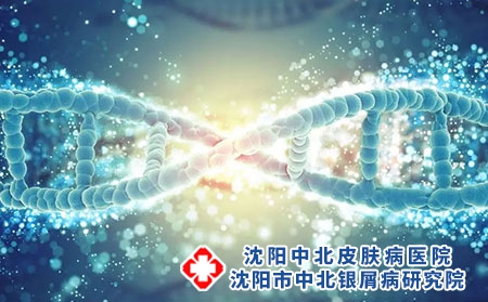 维生素D可减轻牛皮癣相关的炎症