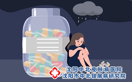 点滴型银屑病该怎么治疗比较好