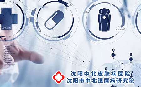 沈阳银屑病患者治疗期间要注意的事项