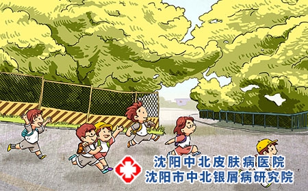 儿童银屑病运动有什么好处？