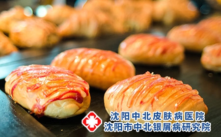 银屑病患者经常吃夜宵会怎么样