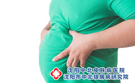 2 (51)肥胖
