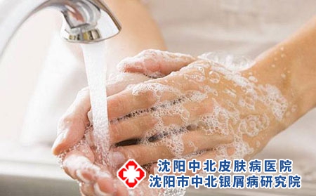 沈阳中北牛皮癣医院：患有银屑病还怎么护理呢?