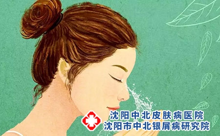 牛皮癣脸上长癣干燥脱皮怎么办呢