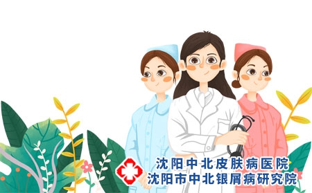 如何摆脱治牛皮癣的误区?