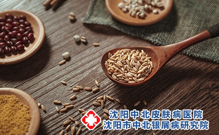沈阳专治牛皮癣病：牛皮癣宜吃什么食物好呢