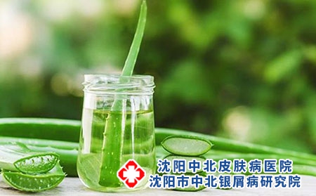 沈阳治银屑病医院：银屑病患者的注意事项