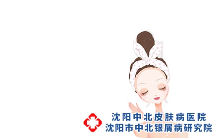沈阳牛皮癣医院：牛皮癣较好治疗药是哪种?