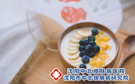 女性银屑病患者能吃燕窝吗？