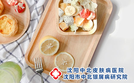 夏季要如何对银屑病进行饮食治疗