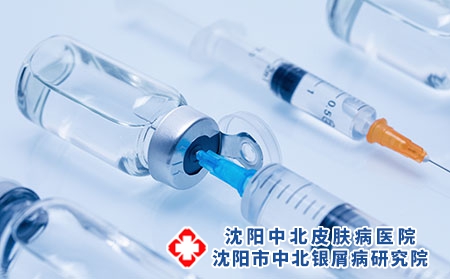 沈阳有什么治银屑病的好医院-生物制剂停了一定会复发吗