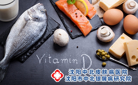 沈阳治疗牛皮癣专科医院饮食科普：牛皮癣吃什么维生素有效