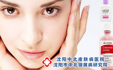 脸部银屑病可以用哪些物理治疗方法?