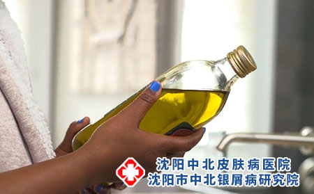 银屑病的辨证分型是什么?