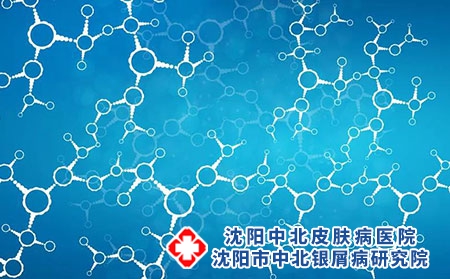 治疗牛皮癣的费用是多少-牛皮癣的治疗方法