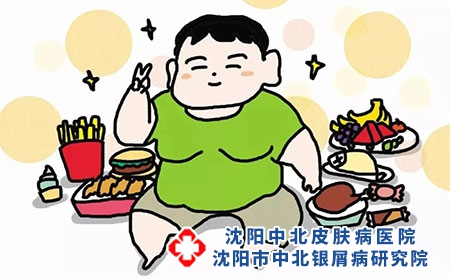 银屑病患者在日常生活中需要注意什么?