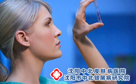 导致银屑病的发生和发展的多种因素