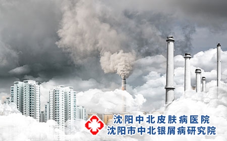哪些环境因素影响牛皮癣?