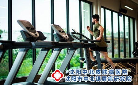 患有牛皮癣患者们能做运动吗?