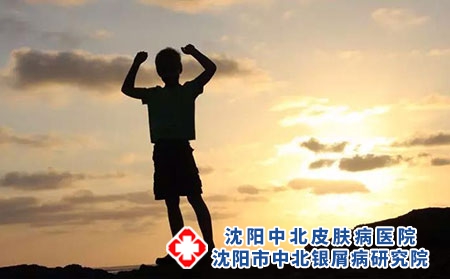 红皮病型牛皮癣的预后如何?