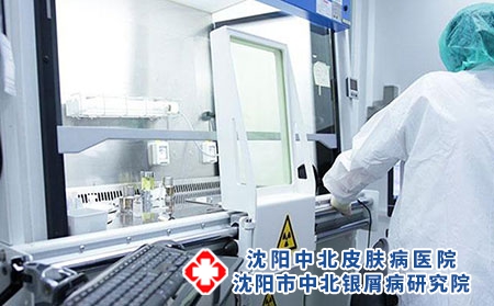 脓疱型牛皮癣形成的原因