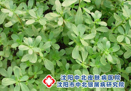 治疗银屑病有益处的食物?