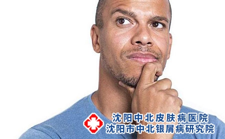 脓包型牛皮癣皮屑长得很快吗?
