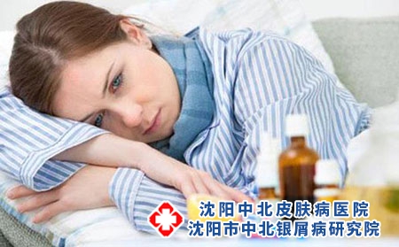 牛皮癣治疗土方法有哪些 得了牛皮癣必须及时诊治