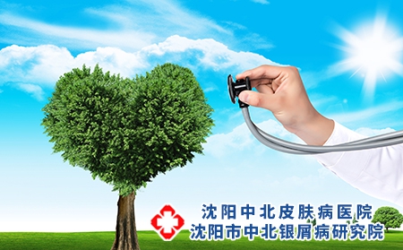 银屑病对患者的伤害是哪些?