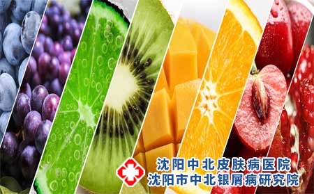 维生素C治疗牛皮癣的作用有哪些?