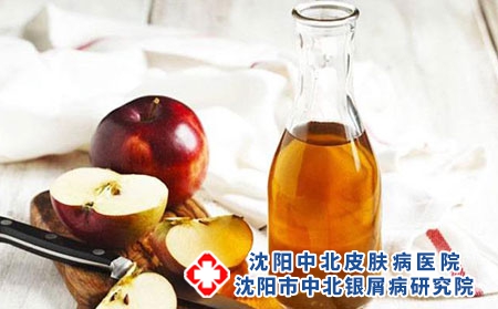 造成牛皮癣的三个原因?