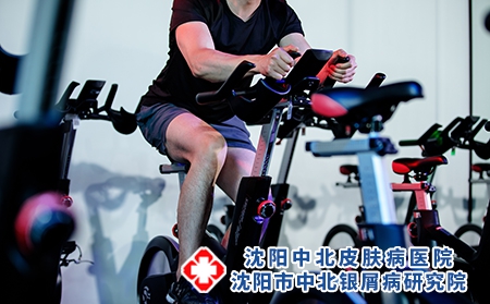 出汗对牛皮癣患者有益吗?