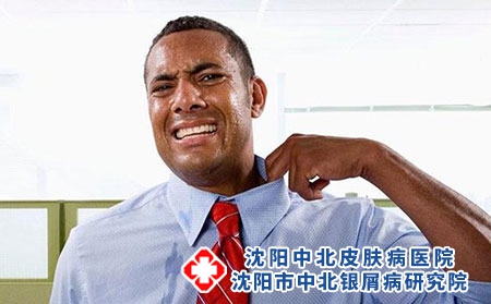 得了牛皮癣还能养宠物吗？