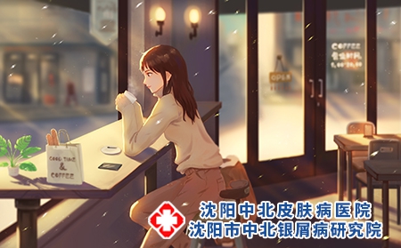 银屑病患者在冬季的护理方法?