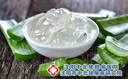 银屑病抹芦荟对皮肤好吗?