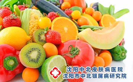 银屑病吃药期间有什么忌口？