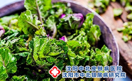 患牛皮癣食疗方法知多少