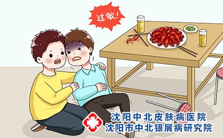 牛皮癣患者可以吃小龙虾吗？